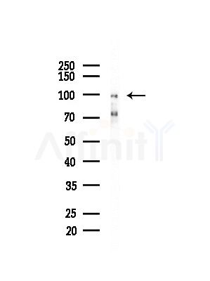 HGS Antibody - Western blot analysis of lysates from Mouse liver, using HGS Antibody at 1/1000 dilution.