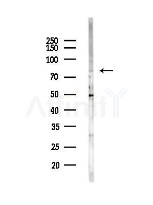 TBX 2/3 Antibody - Western blot analysis of lysates from EC304 cells(heat-shock,45min treatment), using TBX 2/3 Antibody at 1/1000 dilution.