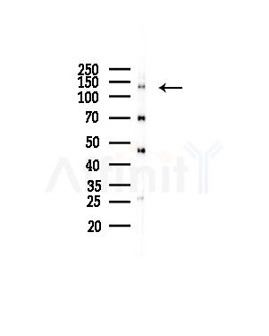 TRIM24 Antibody - Western blot analysis of lysates from COLO205 cells(heat-shock,45min treatment), using TRIM24 Antibody at 1/1000 dilution.