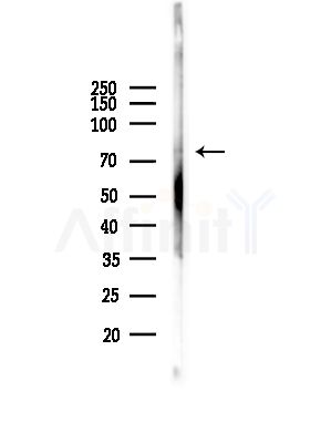 TRI18 Antibody - Western blot analysis of lysates from Hela cells(heat-shock,45min treatment), using TRI18 Antibody at 1/1000 dilution.