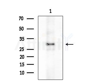 TWEAK Antibody - Western blot analysis of extracts from COLO205 cells, using TWEAK Antibody at 1/1000 dilution.