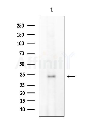 TWEAK Antibody - Western blot analysis of extracts from EC304 cells, using TWEAK Antibody at 1/1000 dilution.