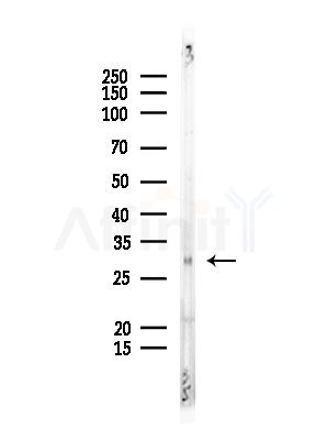 TWEAK Antibody - Western blot analysis of lysates from EC304 cells, using TWEAK Antibody at 1/1000 dilution.