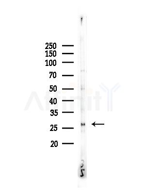 TWEAK Antibody - Western blot analysis of lysates from COLO205 cells, using TWEAK Antibody at 1/1000 dilution.