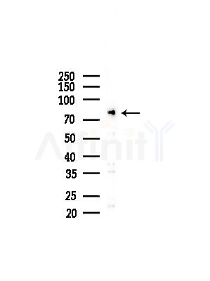 AKAP8 Antibody - Western blot analysis of lysates from LoVo cells(heat-shock,45min treatment), using AKAP8 Antibody at 1/1000 dilution.