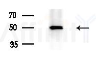 DLX3 Antibody - Western blot analysis of extracts from A375 cells(heat-shock treatment), using DLX3 Antibody at 1/1000 dilution.