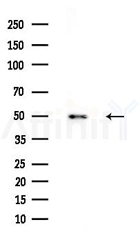 DLX3 Antibody - Western blot analysis of extracts from COLO205 cells(heat-shock treatment), using DLX3 Antibody at 1/1000 dilution.