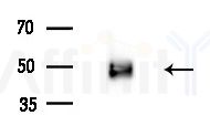 DLX3 Antibody - Western blot analysis of extracts from Rat brain, using DLX3 Antibody at 1/1000 dilution.