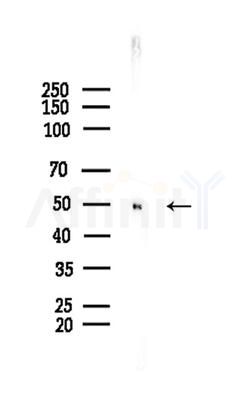 DLX3 Antibody - Western blot analysis of lysates from COLO205 cells(heat-shock,45min treatment), using DLX3 Antibody at 1/1000 dilution.