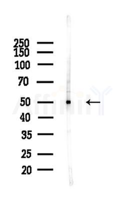 DLX3 Antibody - Western blot analysis of lysates from A375 cells(heat-shock,45min treatment), using DLX3 Antibody at 1/1000 dilution.
