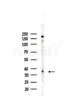 LMX1B Antibody - Western blot analysis of lysates from PC12 cells(LPS, 4h treatment), using LMX1B Antibody at 1/1000 dilution.