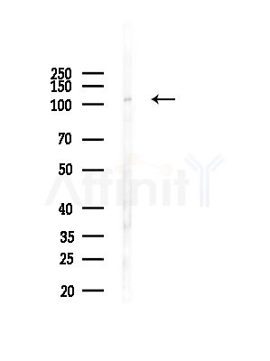 MED24 Antibody - Western blot analysis of lysates from Hela cells(LPS, 4h treatment), using MED24 Antibody at 1/1000 dilution.