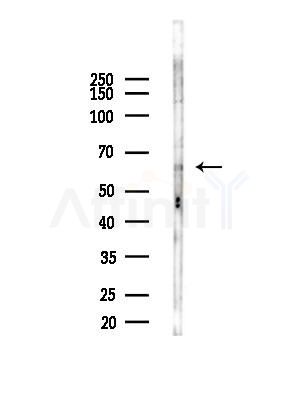 TAF5L Antibody - Western blot analysis of lysates from Rat brain, using TAF5L Antibody at 1/1000 dilution.