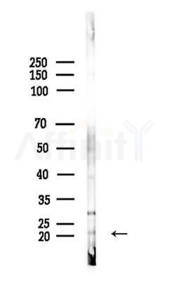 CIB2 Antibody - Western blot analysis of lysates from Rat brain, using CIB2 Antibody at 1/1000 dilution.