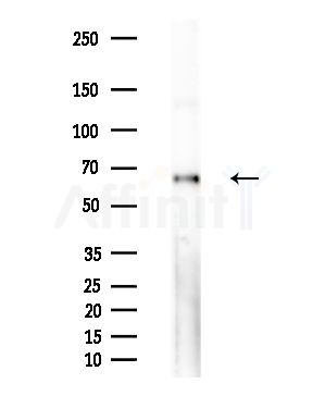 TRIM16 Antibody - Western blot analysis of extracts from HepG2 cells(starvation,24h treatment), using TRIM16 Antibody at 1/1000 dilution.