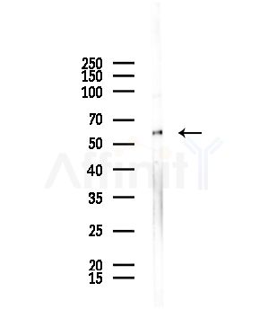 TRIM16 Antibody - Western blot analysis of lysates from HepG2 cells(starvation,24h treatment), using TRIM16 Antibody at 1/1000 dilution.