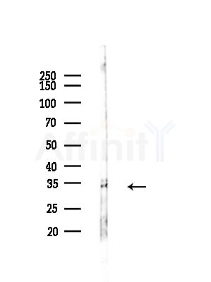 MBD3 Antibody - Western blot analysis of lysates from COLO205 cells(heat-shock,45min treatment), using MBD3 Antibody at 1/1000 dilution.