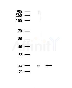 TSPAN8 Antibody - Western blot analysis of lysates from B16F10-LUC cells(UV,30min treatment), using TSPAN8 Antibody at 1/1000 dilution.