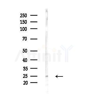 TSPAN8 Antibody - Western blot analysis of lysates from MCF7 cells(heat-shock,45min treatment), using TSPAN8 Antibody at 1/1000 dilution.
