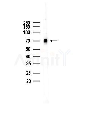 NXF1 Antibody - Western blot analysis of lysates from COLO205 cells(UV,30min treatment), using NXF1 Antibody at 1/1000 dilution.