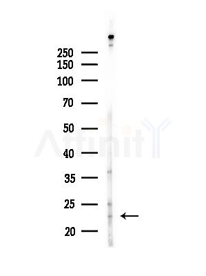RPS9 Antibody - Western blot analysis of lysates from Hela cells(starvation,24h treatment), using RPS9 Antibody at 1/1000 dilution.