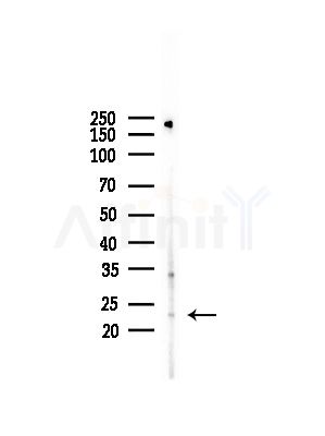 RPS9 Antibody - Western blot analysis of lysates from LoVo cells(heat-shock,45min treatment), using RPS9 Antibody at 1/1000 dilution.