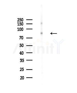 MAN1B1 Antibody - Western blot analysis of lysates from Hela cells(starvation,24h treatment), using MAN1B1 Antibody at 1/1000 dilution.