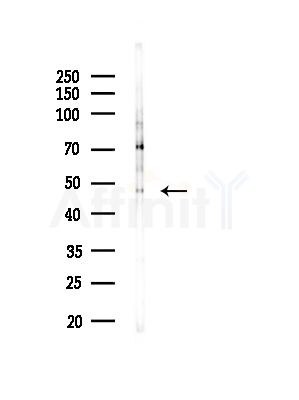 CBX6 Antibody - Western blot analysis of lysates from A375 cells(LPS, 4h treatment), using CBX6 Antibody at 1/1000 dilution.