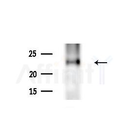 TFIP8 Antibody - Western blot analysis of extracts from HUVEC cells(starvation,24h treatment), using TFIP8 Antibody at 1/1000 dilution.