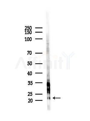 TFIP8 Antibody - Western blot analysis of lysates from HUVEC cells(starvation,24h treatment), using TFIP8 Antibody at 1/1000 dilution.