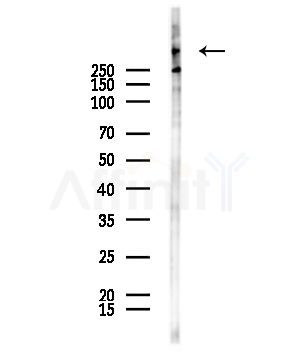 ATRX Antibody - Western blot analysis of lysates from HepG2 cells(starvation,24h treatment), using ATRX Antibody at 1/1000 dilution.