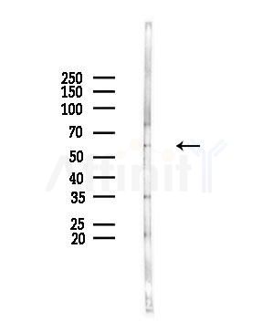 TINF2 Antibody - Western blot analysis of lysates from HUVEC cells(UV,30min treatment), using TINF2 Antibody at 1/1000 dilution.