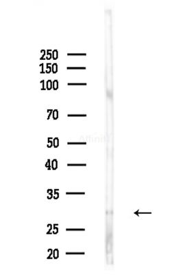 CIB3 Antibody - Western blot analysis of lysates from Hela cells(heat-shock,45min treatment), using CIB3 Antibody at 1/1000 dilution.