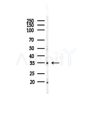 MMTAG2 Antibody - Western blot analysis of lysates from COLO205 cells(heat-shock,45min treatment), using MMTAG2 Antibody at 1/1000 dilution.