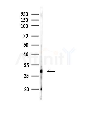 MMTAG2 Antibody - Western blot analysis of lysates from RAW264.