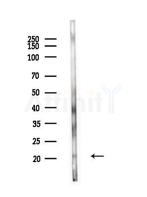 APRIL/TNFSF13 Antibody - Western blot analysis of lysates from Mouse testis, using APRIL/TNFSF13 Antibody at 1/1000 dilution.