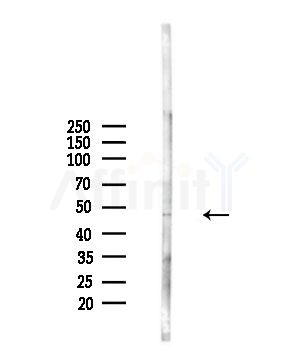 ZNF436 Antibody - Western blot analysis of lysates from A375 cells(starvation,24h treatment), using ZNF436 Antibody at 1/1000 dilution.