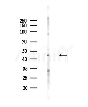 ZNF436 Antibody - Western blot analysis of lysates from HepG2 cells(LPS,4h treatment), using ZNF436 Antibody at 1/1000 dilution.
