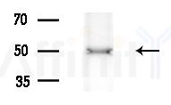DUS2L Antibody - Western blot analysis of extracts from A375 cells(heat-shock treatment), using DUS2L Antibody at 1/1000 dilution.
