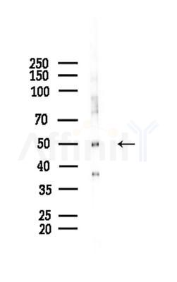 DUS2L Antibody - Western blot analysis of lysates from COLO205 cells(heat-shock,45min treatment), using DUS2L Antibody at 1/1000 dilution.