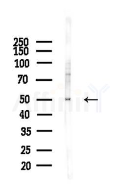 DUS2L Antibody - Western blot analysis of lysates from A375 cells(heat-shock,45min treatment), using DUS2L Antibody at 1/1000 dilution.