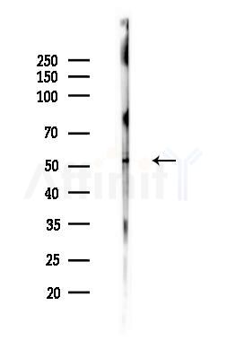 MEF2C Antibody - Western blot analysis of lysates from B16F10-LUC cells(heat-shock,45min treatment), using MEF2C Antibody at 1/1000 dilution.