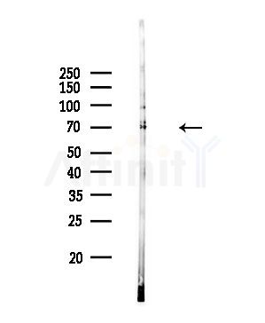 DCLK3 Antibody - Western blot analysis of lysates from Rat brain, using DCLK3 Antibody at 1/1000 dilution.