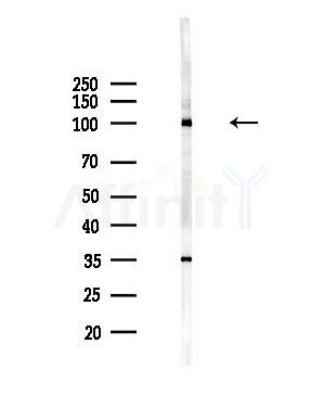 TUBGCP3 Antibody - Western blot analysis of lysates from HepG2 cells(LPS,4h treatment), using TUBGCP3 Antibody at 1/1000 dilution.