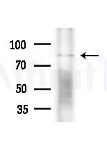 MED17 Antibody - Western blot analysis of lysates from PC12 cells(LPS,4h treatment), using MED17 Antibody at 1/1000 dilution.
