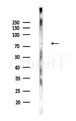 MED17 Antibody - Western blot analysis of lysates from PC12 cells(LPS,4h treatment), using MED17 Antibody at 1/1000 dilution.
