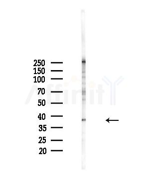 GAS41 Antibody - Western blot analysis of lysates from A375 cells(starvation,24h treatment), using GAS41 Antibody at 1/1000 dilution.