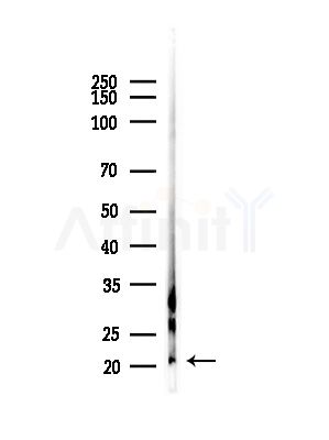 C1orf57 Antibody - Western blot analysis of lysates from B16F10-LUC cells(starvation,24h treatment), using C1orf57 Antibody at 1/1000 dilution.