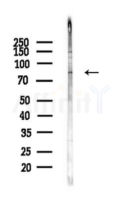 RHOBTB1/2 Antibody - Western blot analysis of lysates from A375 cells(heat-shock,45min treatment), using RHOBTB1/2 Antibody at 1/1000 dilution.