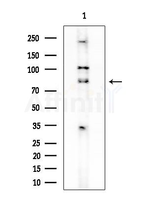 ATF6B Antibody - Western blot analysis of lysates from EC304 cells, using ATF6B Antibody at 1/1000 dilution.